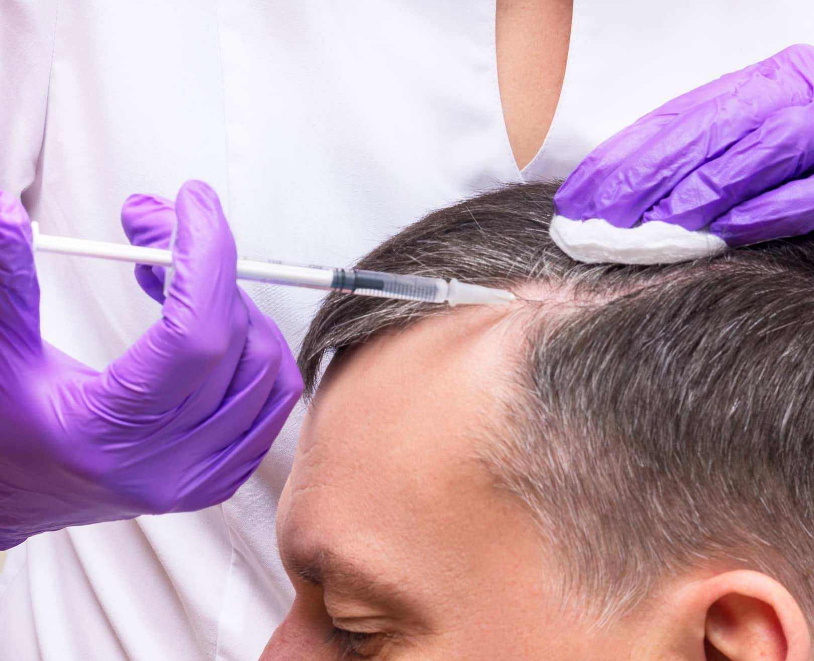 Rejuvenate with PRP – Hair, Face, and Sexual Health!