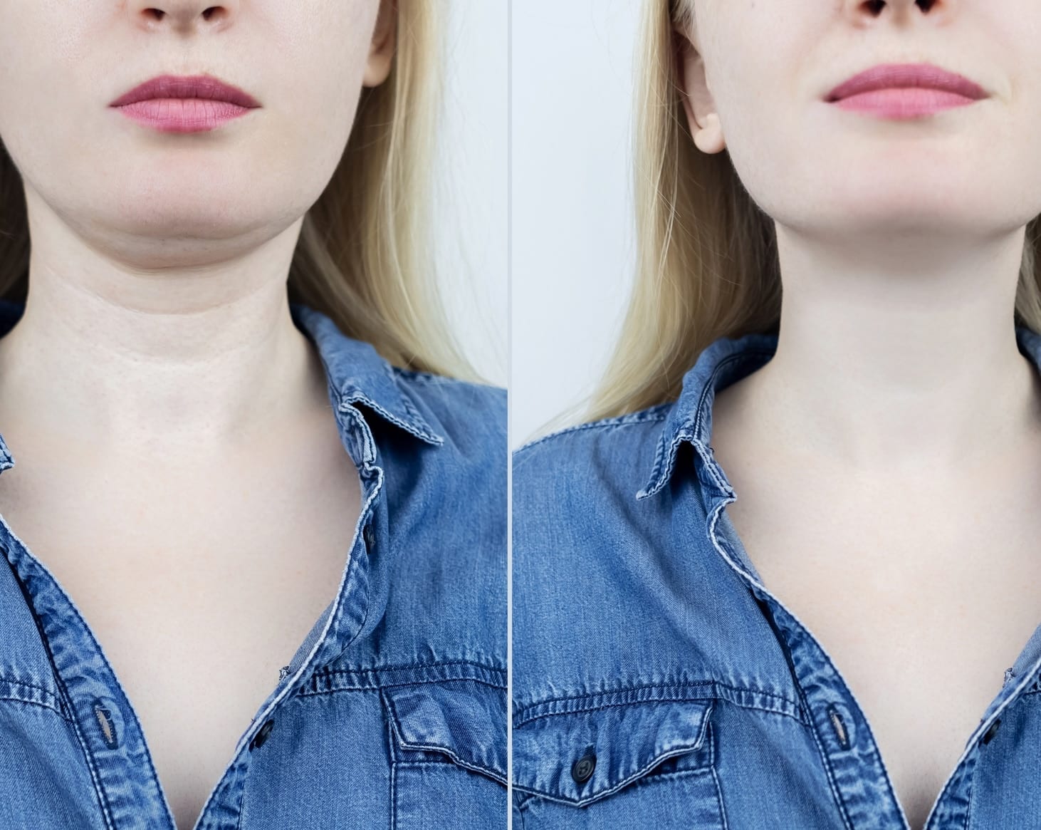 Sculpt Your Jawline